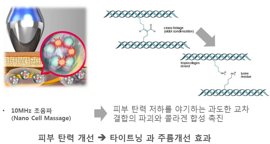 2.콜라겐 연결조직 재구성.jpg