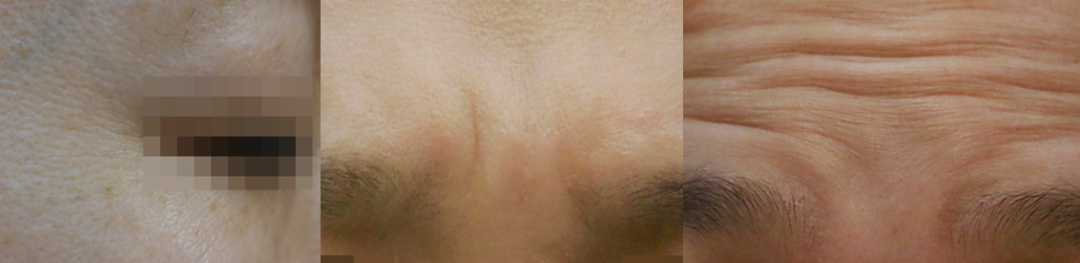 주름종류(2월).png
