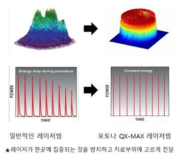 포토나1.jpg