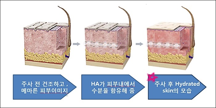 하이드로업원리.jpg