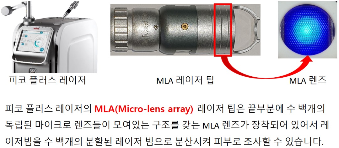 피코MLA 렌즈 기계적 설명.jpg