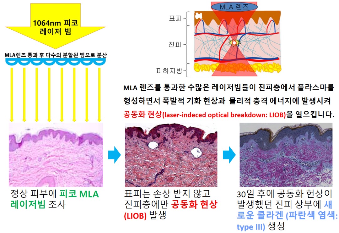 피코 MLA 작용과 결과.jpg