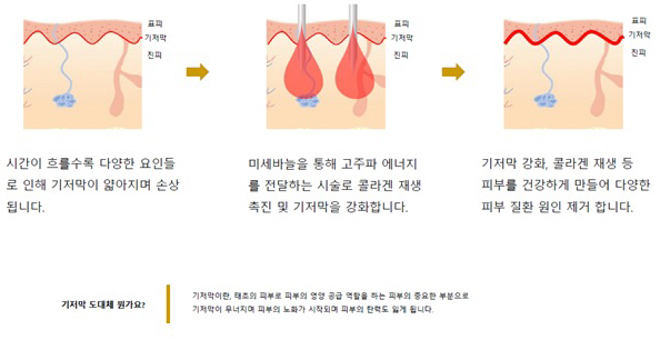 실펌1 (1).jpg