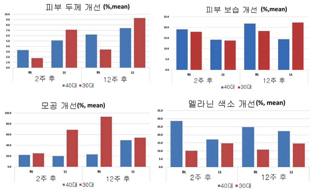 리쥬란 치료 결과-cnp.jpg