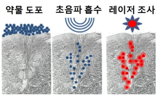 골드PTT_사진.png