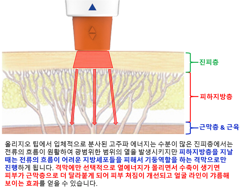 올리지오 피부 리프팅 기전-cnp-002.jpg