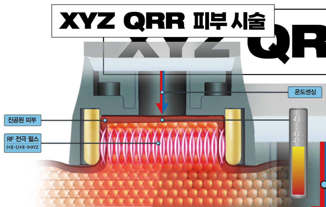 XYZ QRR 피부 시술_대지 1.png