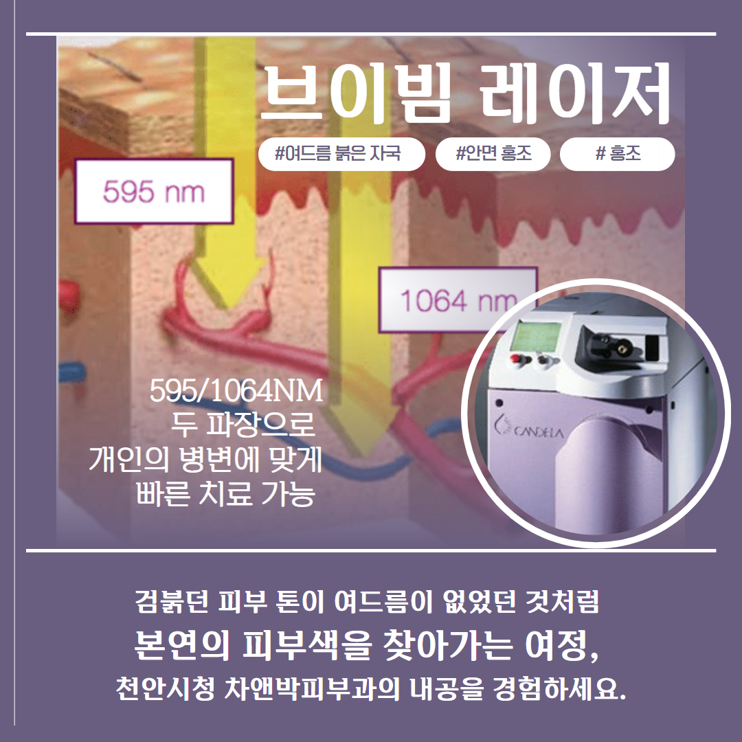 2403_브이빔프로그램_천안시청 2.png