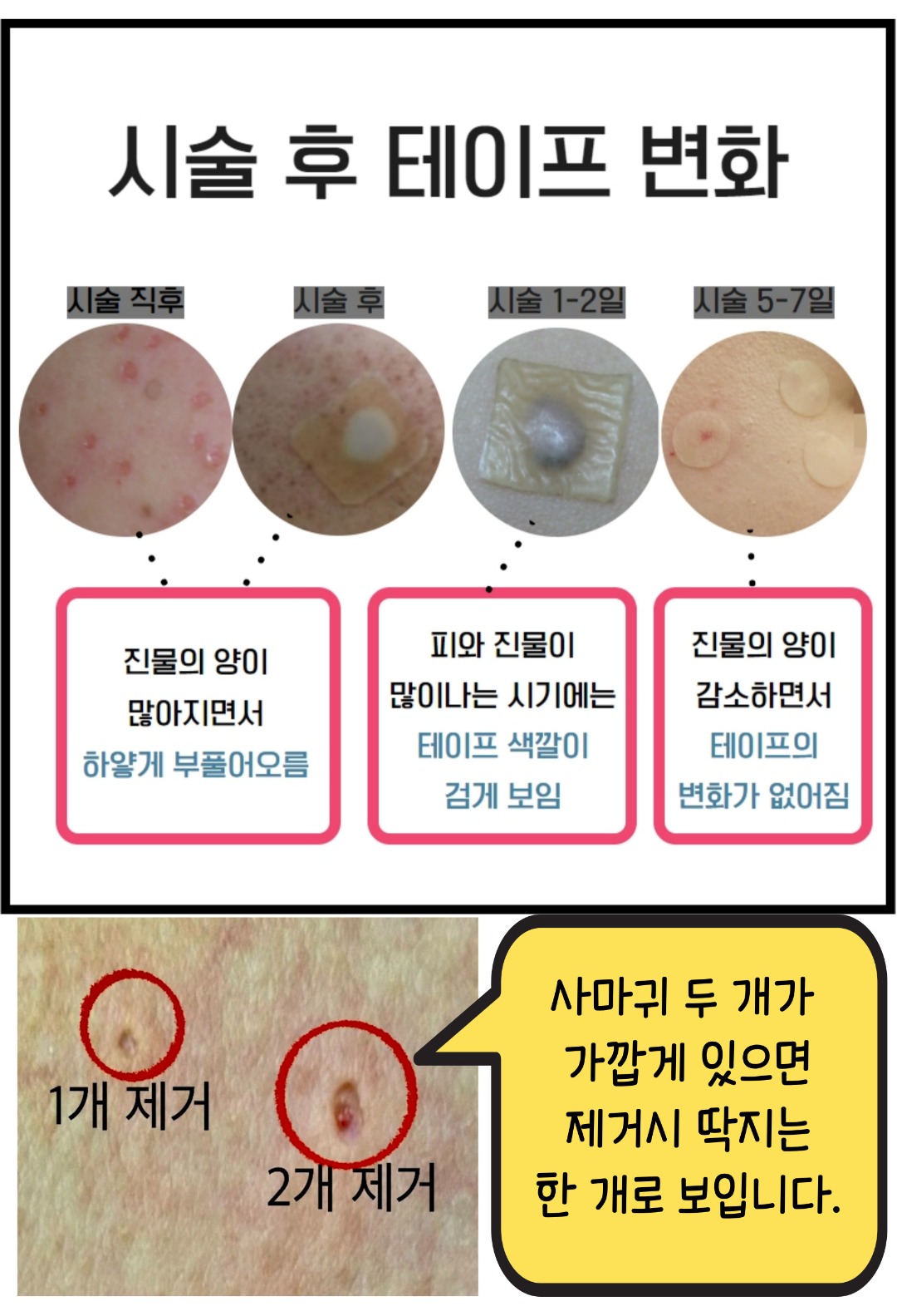 제목을-입력해주세요_-001 (51).jpg