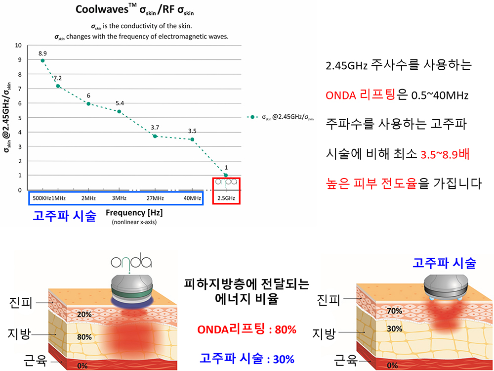 ONDA리프팅과 고주파 시술 비교.jpg