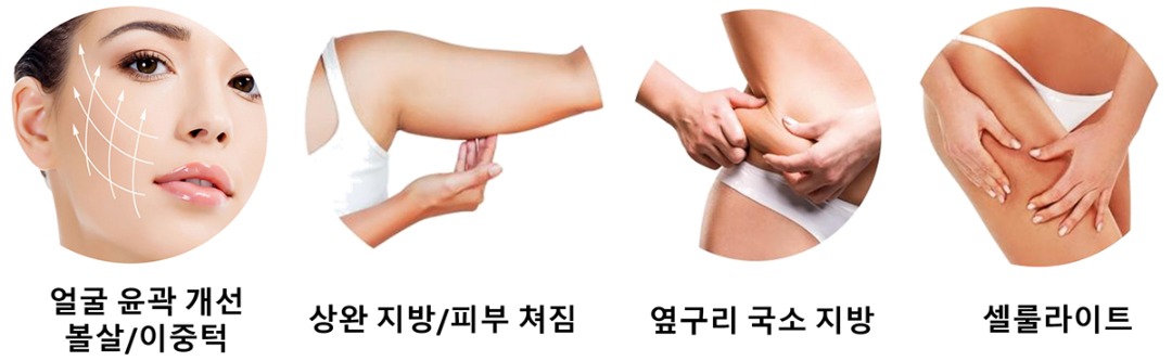 적응증.jpg
