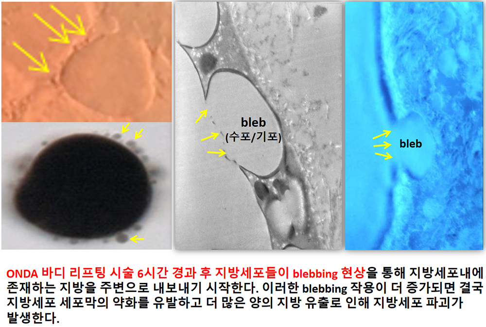 blebbing 현상.jpg