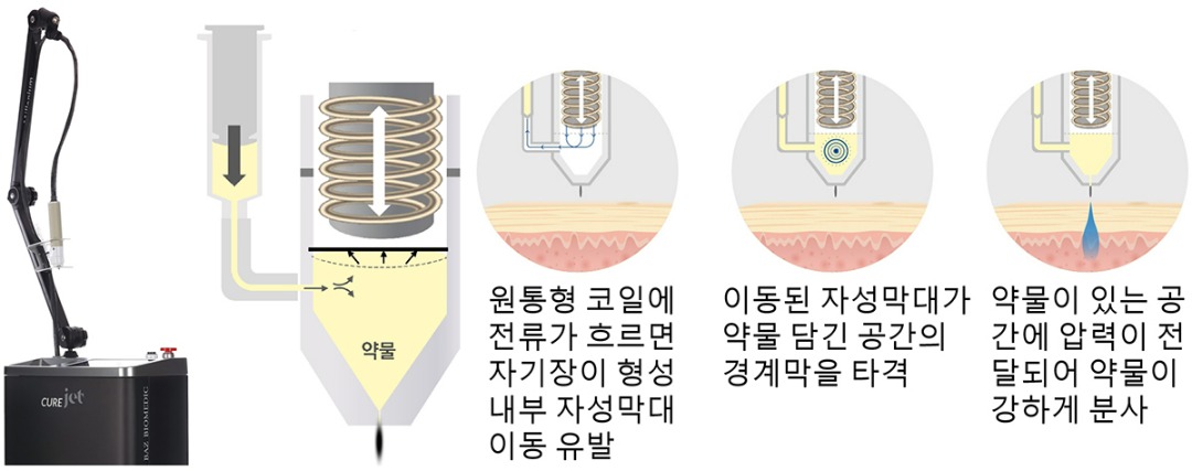 큐어젯 본체와 작동원리-cnp.jpg