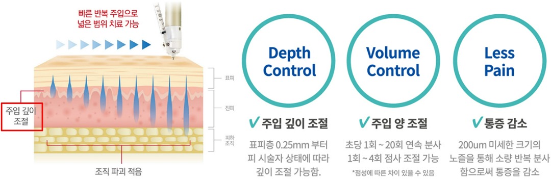 큐어젯 장점 설명.jpg