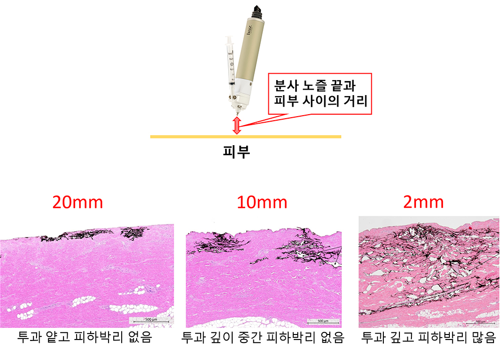 노즐과 피부와의 거리와 투과 깊이.jpg