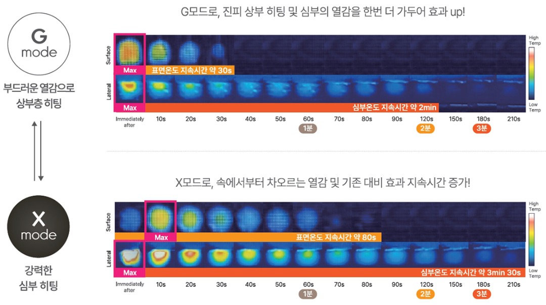 G모드 X모드.jpg