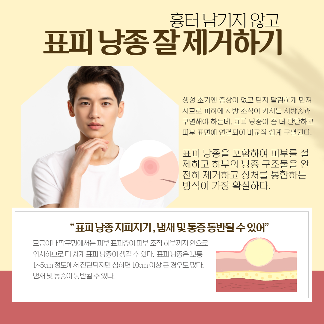 2502_천호점_표피낭종 1.png