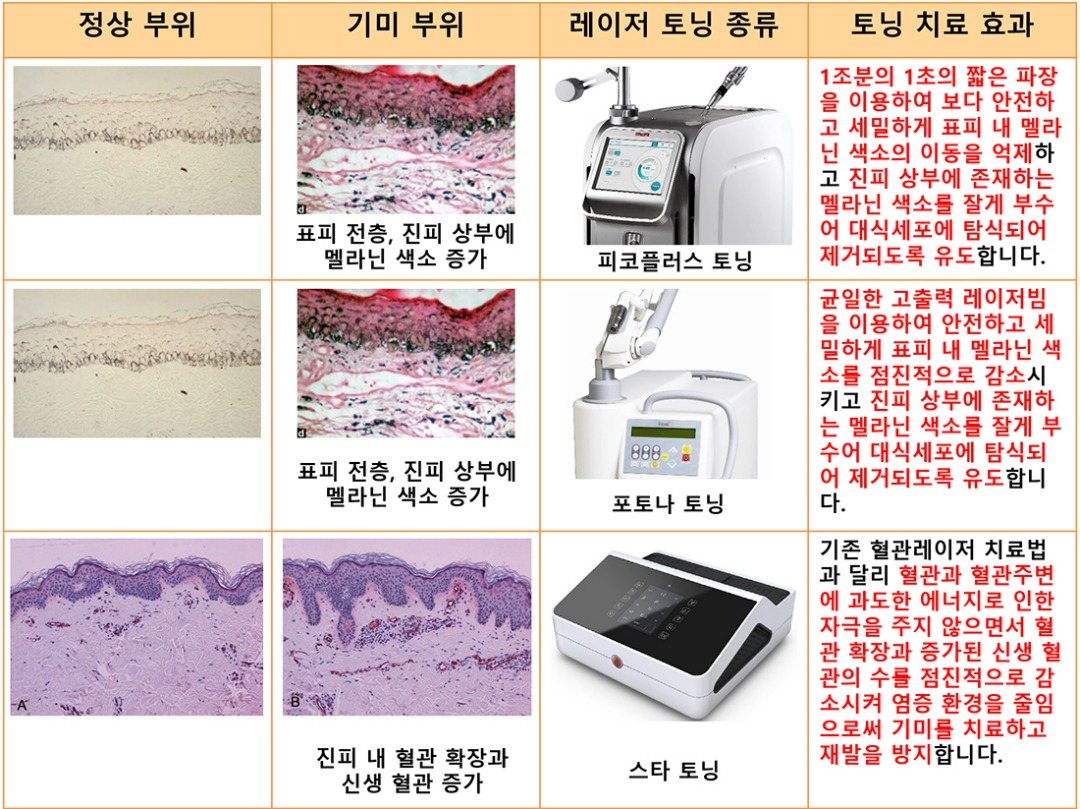 프리미엄토닝표001.jpg
