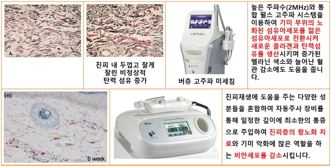 프리미엄토닝표002.jpg