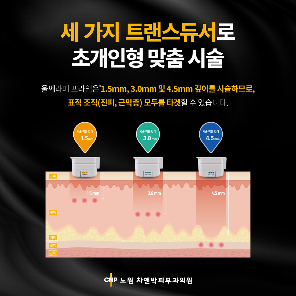 20250805_울쎄라프라임3.jpg