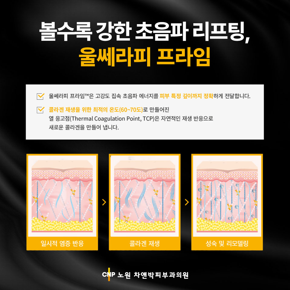 20250805_울쎄라프라임4.jpg