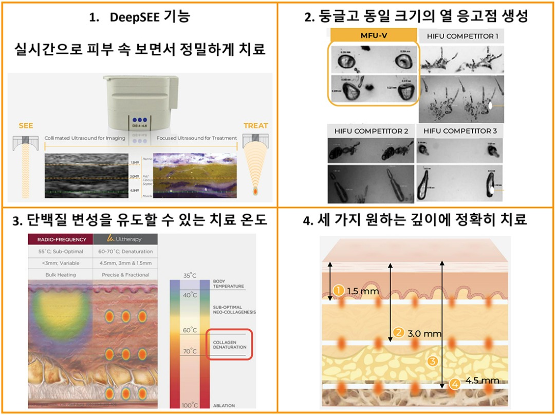 울쎄라 4가지 특징-cnp.jpg