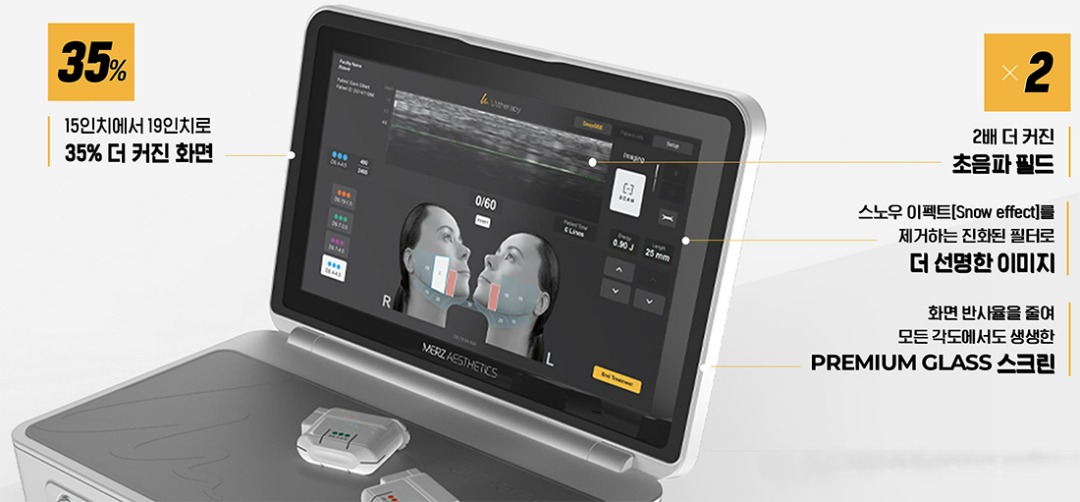 울쎼라 화면 변화-cnp.jpg