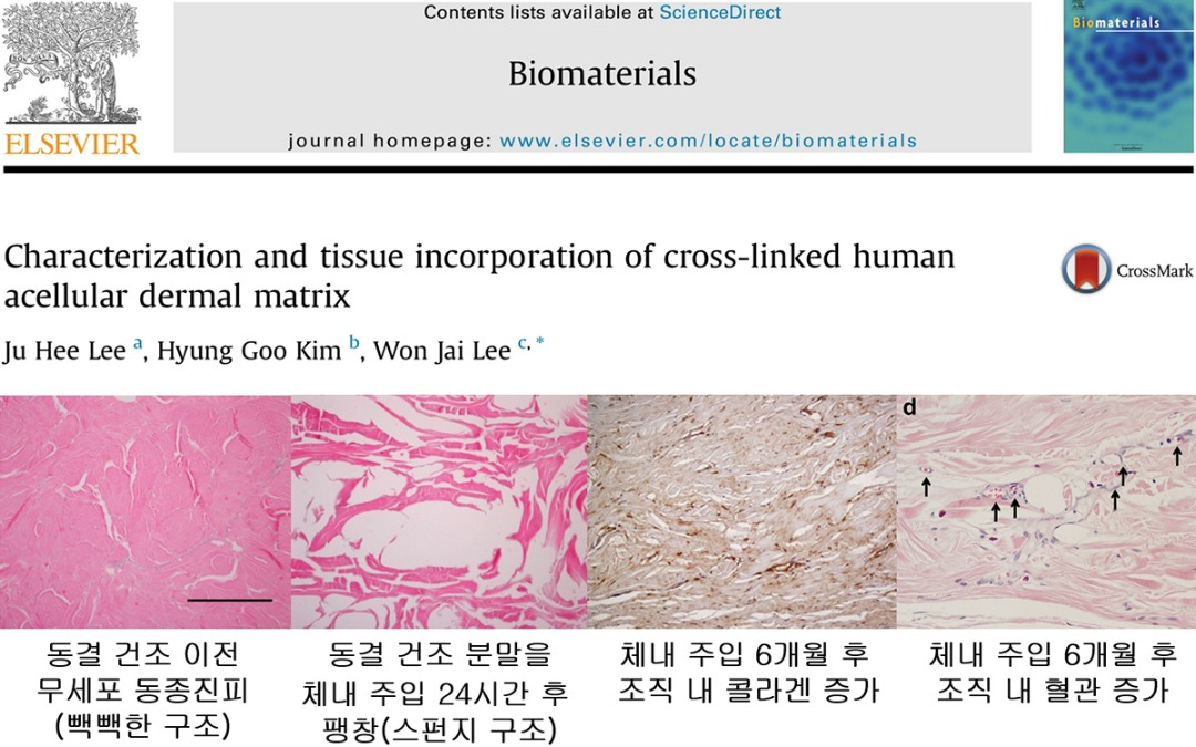 리투오 체내 주입 후 변화 복사.jpg