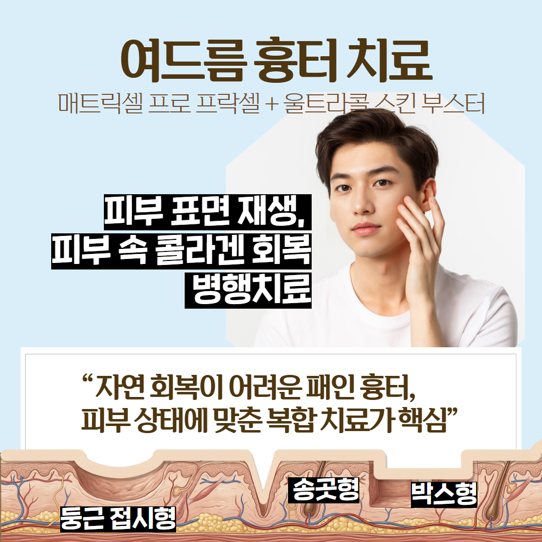 2605_매트릭셀_울트라콜_인천 1.png