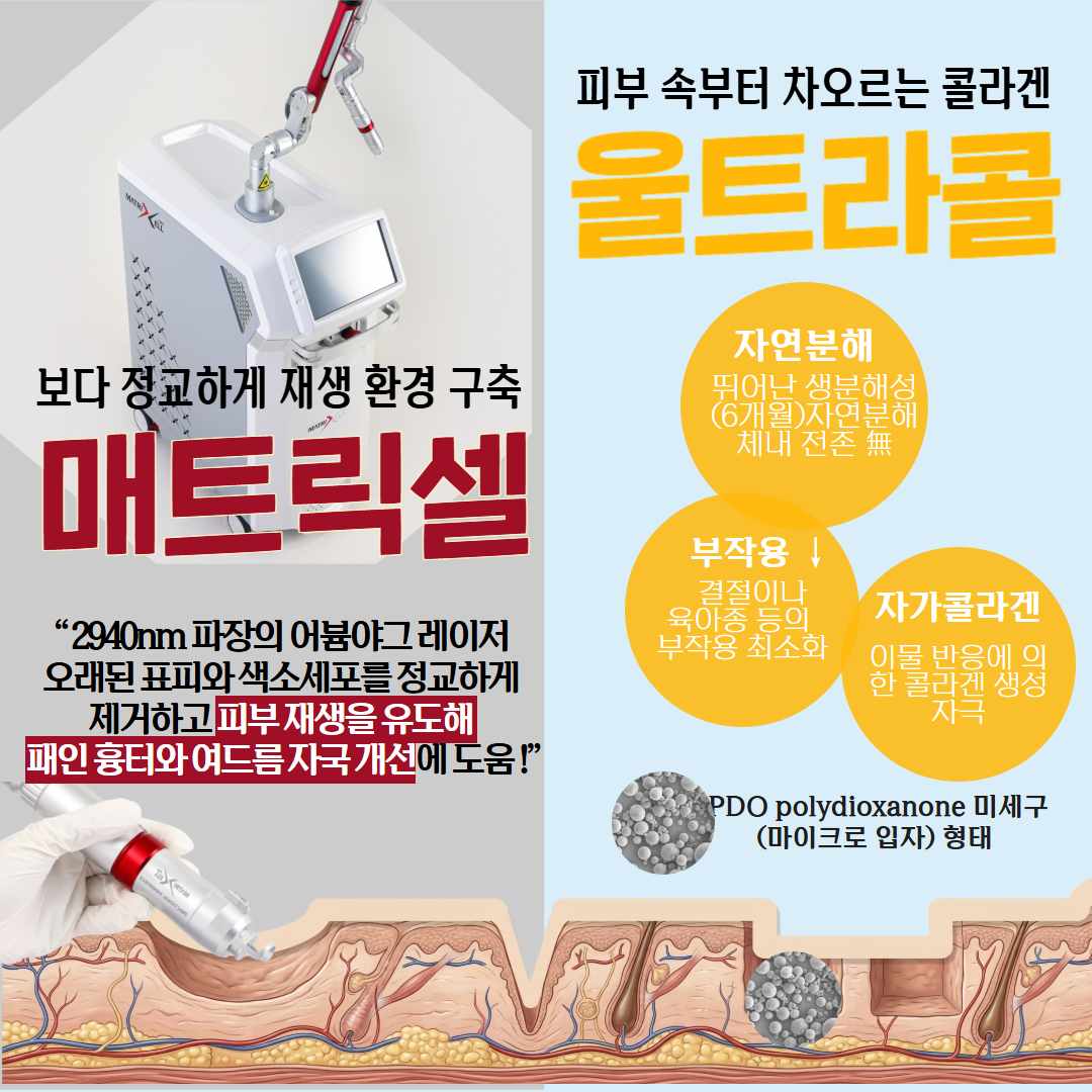 2605_매트릭셀_울트라콜_인천 2.png