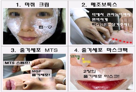 줄기세포정맥주사 피부를 바꿔주는