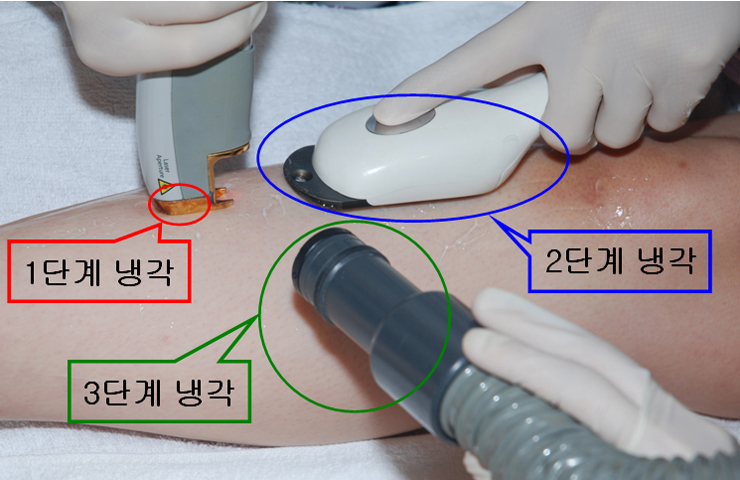 닥터칼럼 | 커뮤니티 | 차앤박피부과