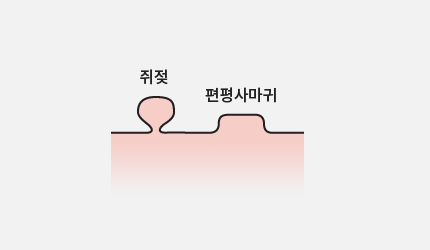 매끄러운 바디피부의 시작! 바디 어븀