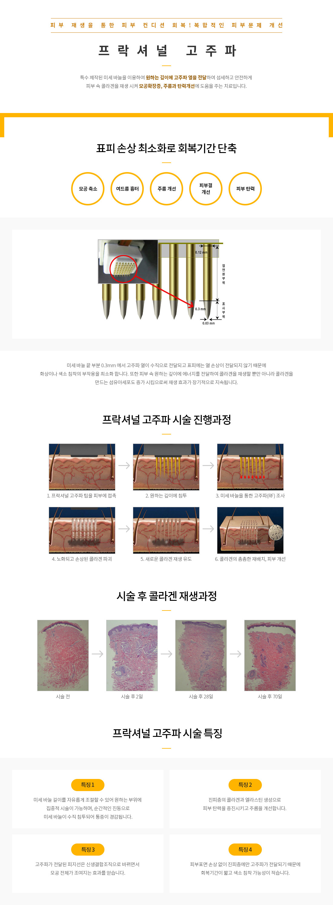 프락셔널고주파