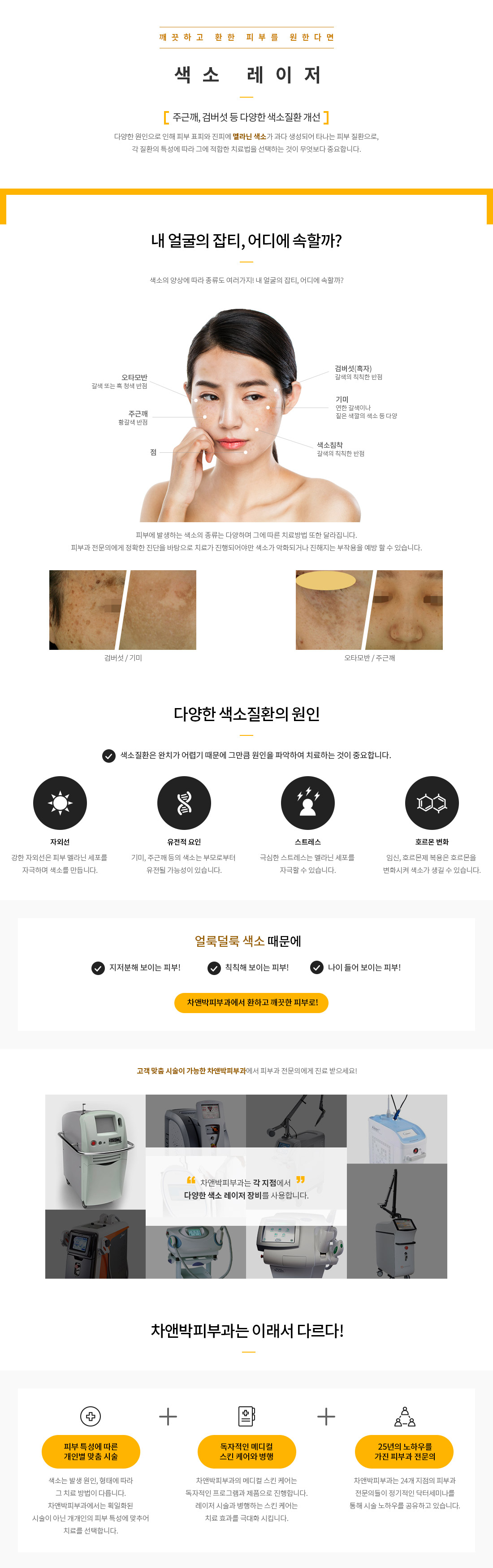 색소레이저