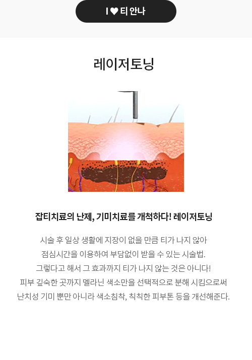 티안나 잡티/미백 레이저토닝
