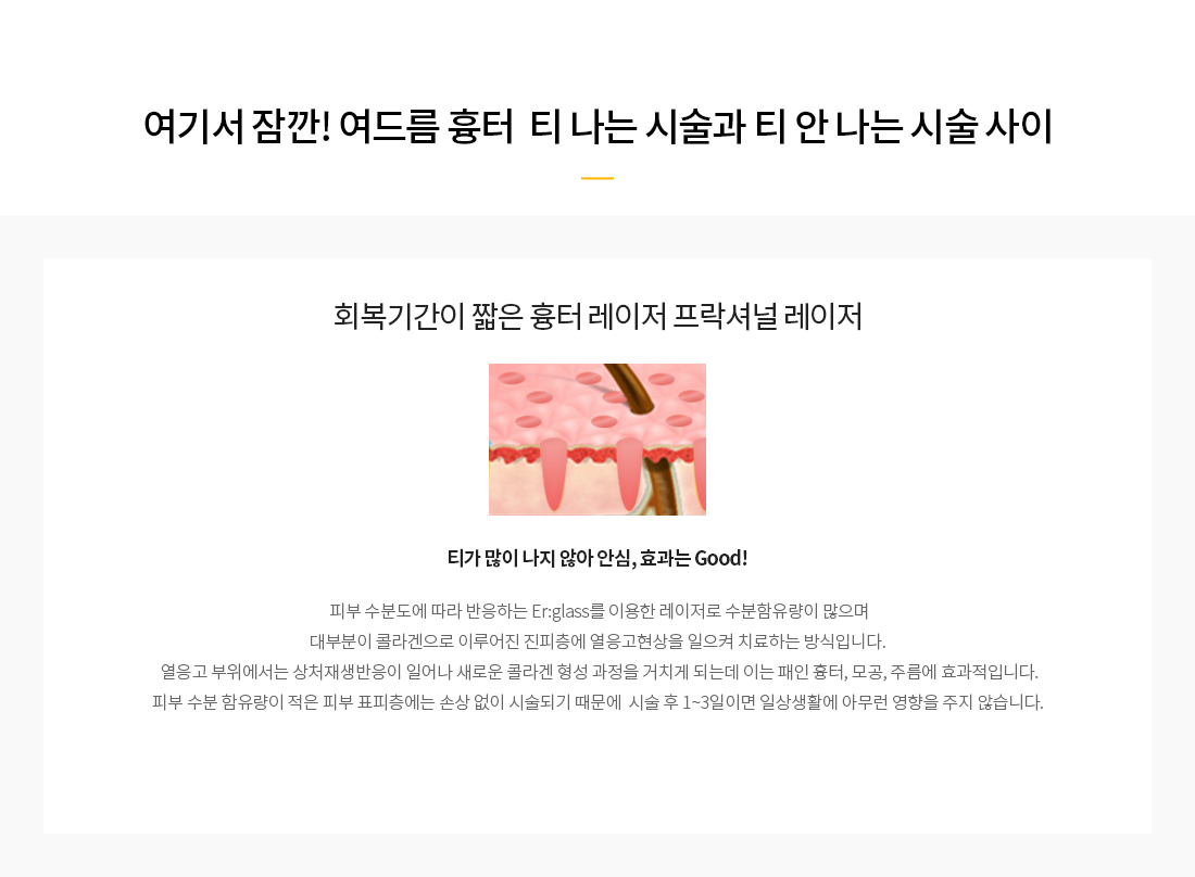 티나vs티안나 흉터레이저 프락셔널 레이저