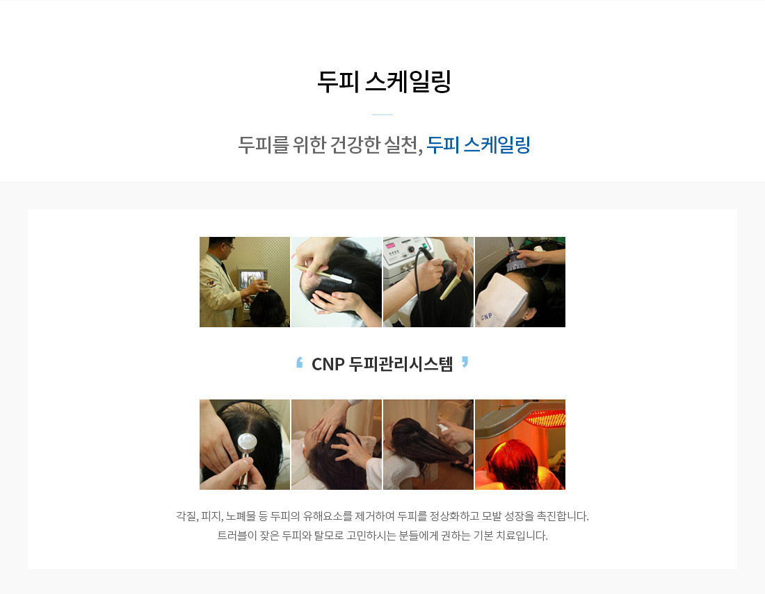 두피 탈모케어-두피 스케일링