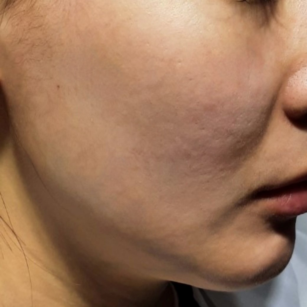 시술후   이미지