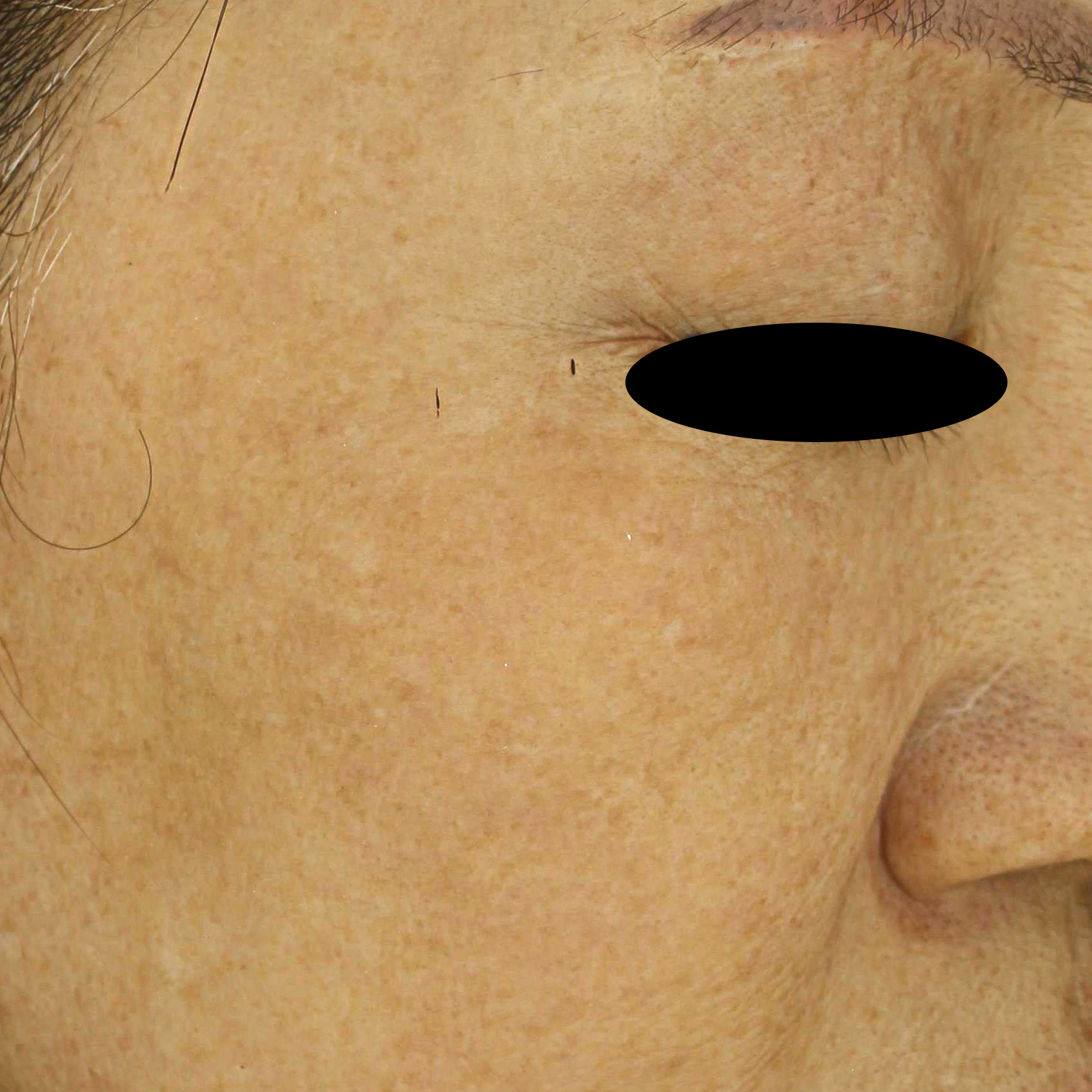 시술후   이미지