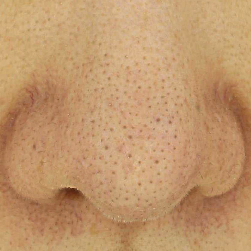 시술전  이미지 