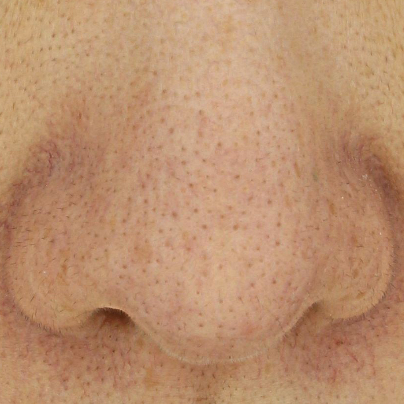 시술후   이미지