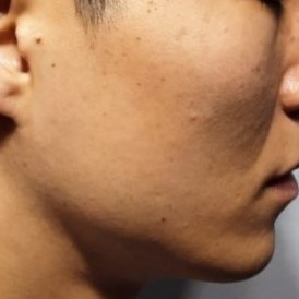 시술전  이미지 