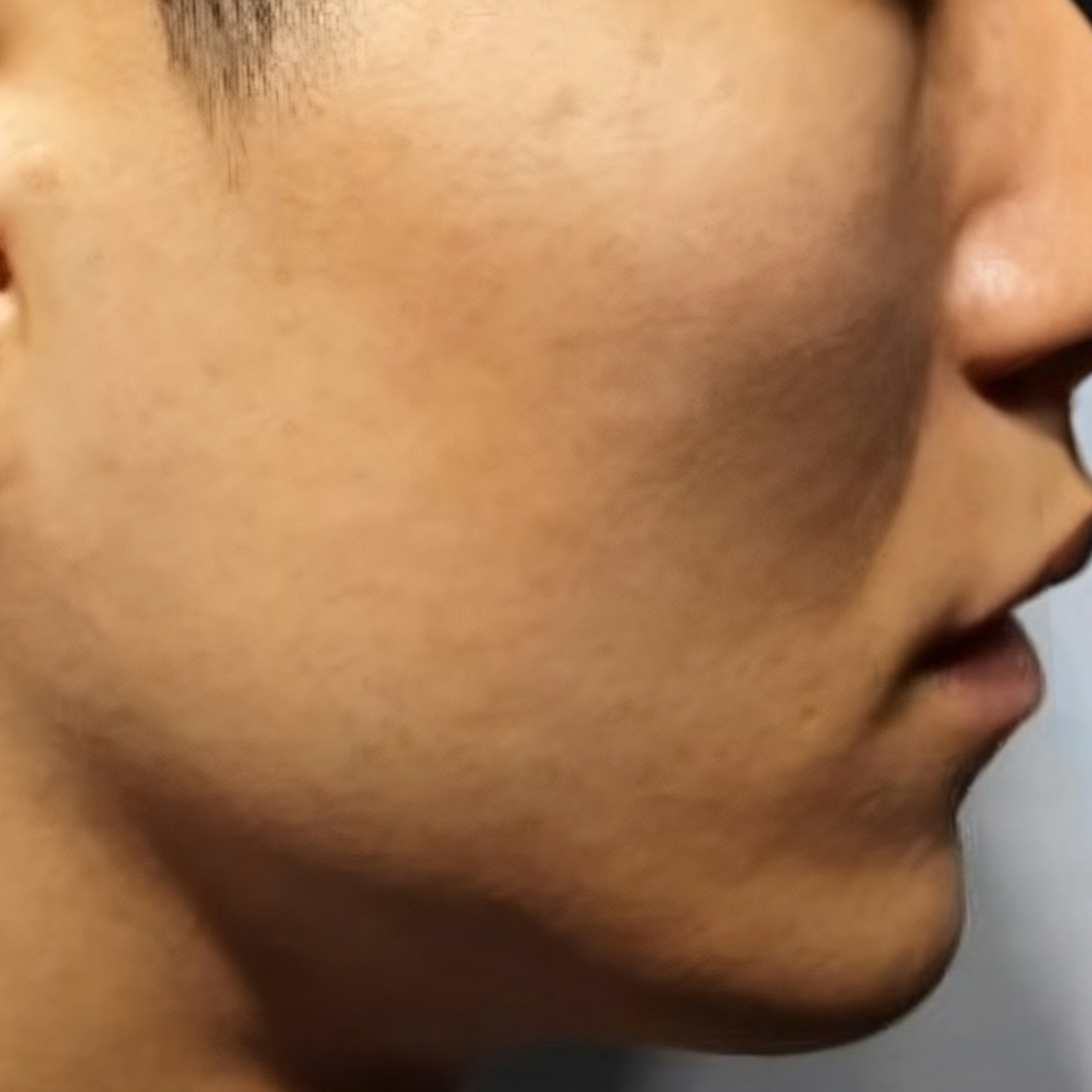 시술후   이미지